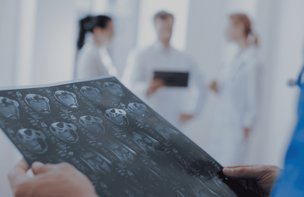 Compensation for a Traumatic Brain Injury (TBI): Important Information